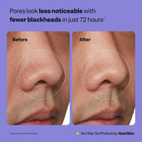 Peach Slices - Nose Pore Patches 7 Patches
