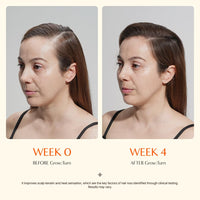 Lilyeve - Grow:Turn Ampoule 100ml