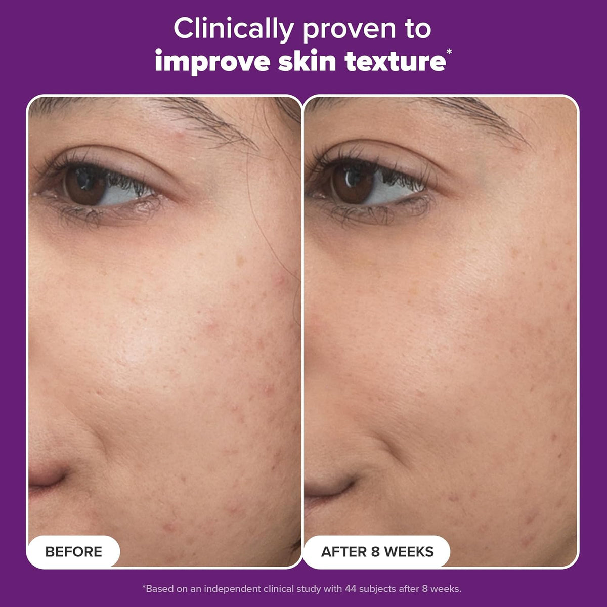 Paula's Choice - PRO Retinaldehyde Dual-Retinoid Treat 30ml