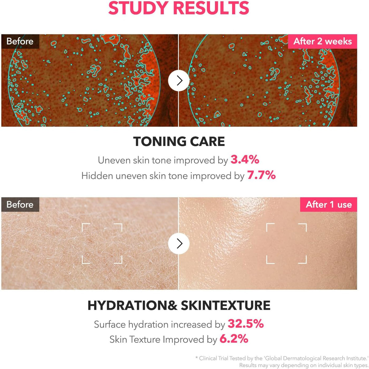 April Skin - TXA Niacinamide 99 Milky Toner 150ml