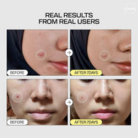 Jumiso - Snail Mucin 95% + Peptide Essence 140ml