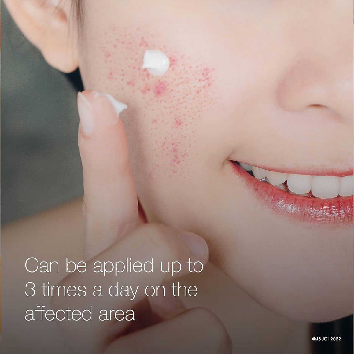 Neutrogena - Rapid Clear Stubborn Acne Spot Gel 28g