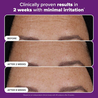 Paula's Choice - PRO Retinaldehyde Dual-Retinoid Treat 30ml