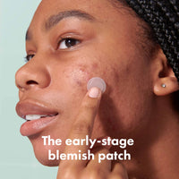 Hero Cosmetics - Mighty Patch Micropoint For Blemishes 8 Patches