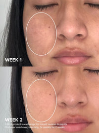 Paula's Choice - Niacinamide 20% Treatment 20ml