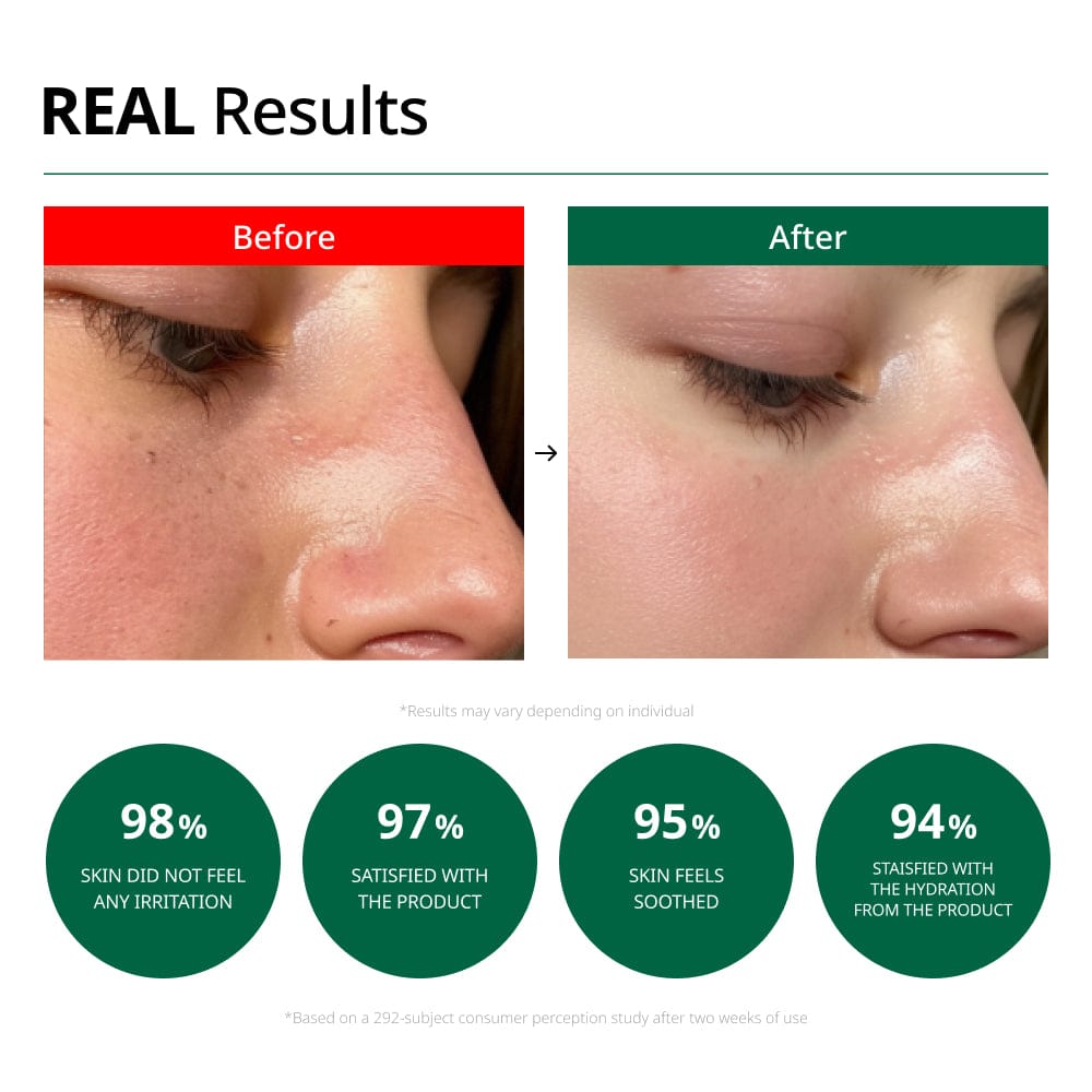 Dr.G - R.E.D Blemish Clear Soothing Cream 70ml