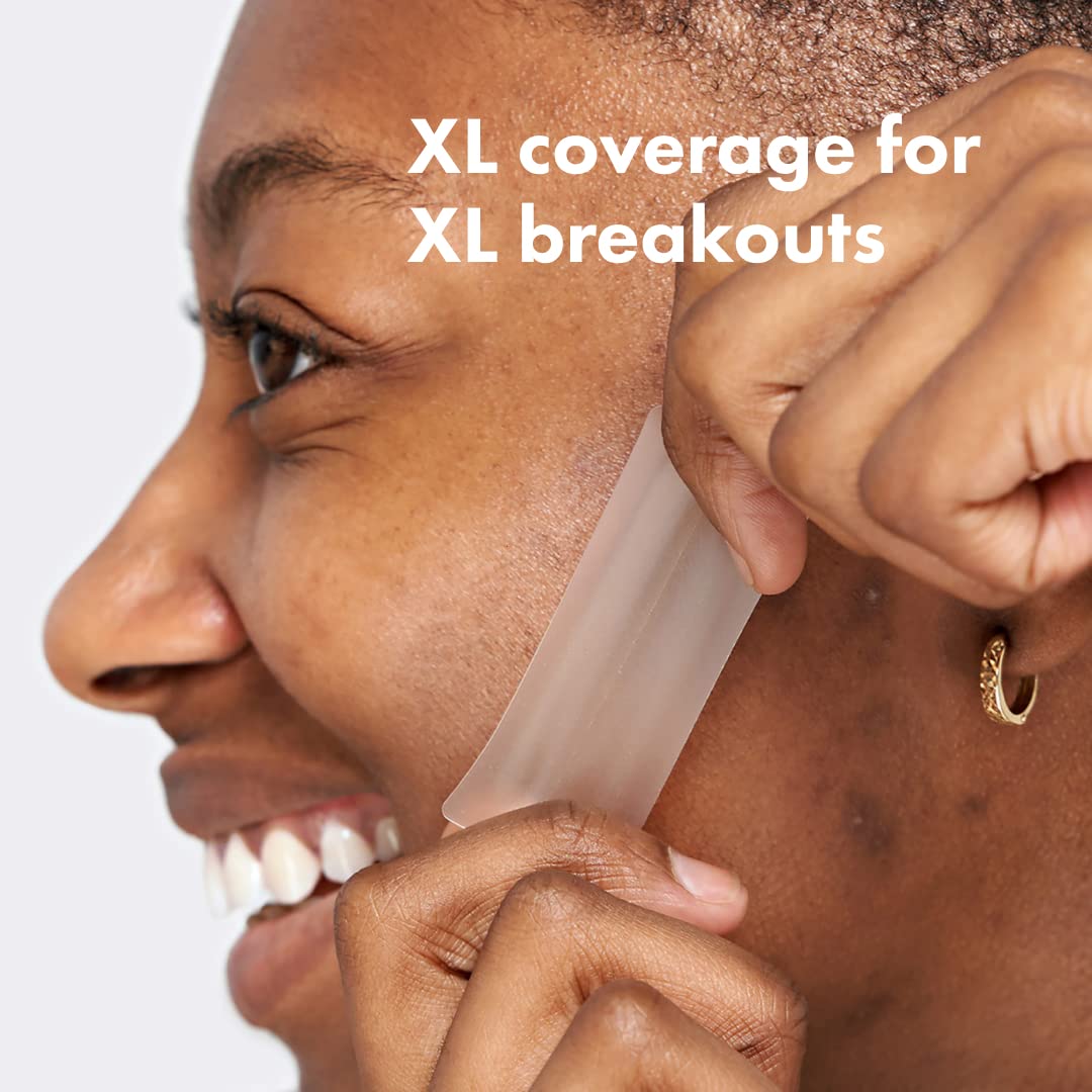 Hero Cosmetics - Mighty Patch Surface 10 Strips