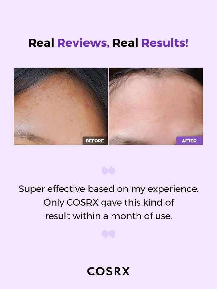 Cosrx - AHA/BHA Clarifying Treatment Toner 150ml