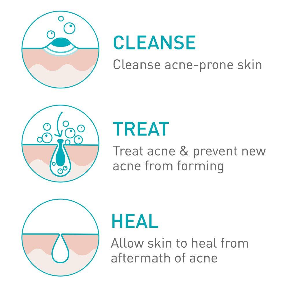 Cerave - Acne Foaming Cream Face Cleanser 150ml