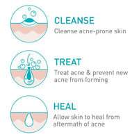 Cerave - Acne Foaming Cream Face Cleanser 150ml