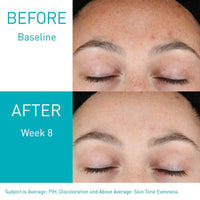 Cerave - Resurfacing Retinol Serum 30ml