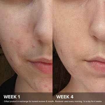 Paula's choice - C15 Super Booster 20ml