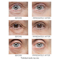 Peter Thomas Roth - Instant FIRMx Temporary Eye Tightener 30ml