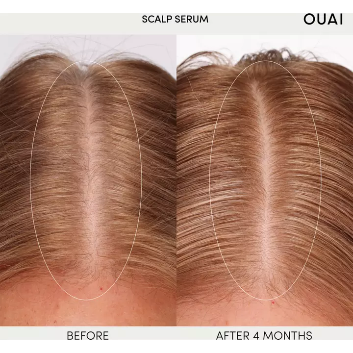 OUAI - Scalp Serum 60ml