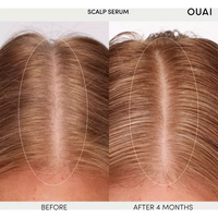 OUAI - Scalp Serum 60ml