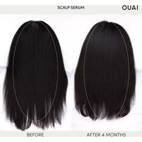 OUAI - Scalp Serum 60ml