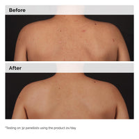 Ordinary - Salicylic Acid 0.5% Body Serum 240ml