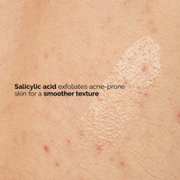 Ordinary - Salicylic Acid 0.5% Body Serum 240ml