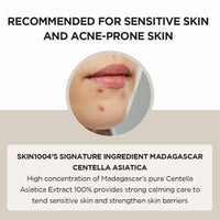 Skin1004 - Madagascar Centella Ampoule 30ml