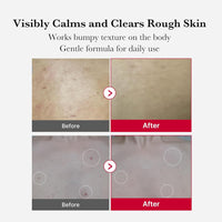 Medicube - Red Acne Body Peeling Shot 2.0 110g