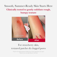 Medicube - Red Acne Body Peeling Shot 2.0 110g