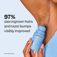 Peach Slices - Smoothing Solution Ingrown Hair Treatment 50ml