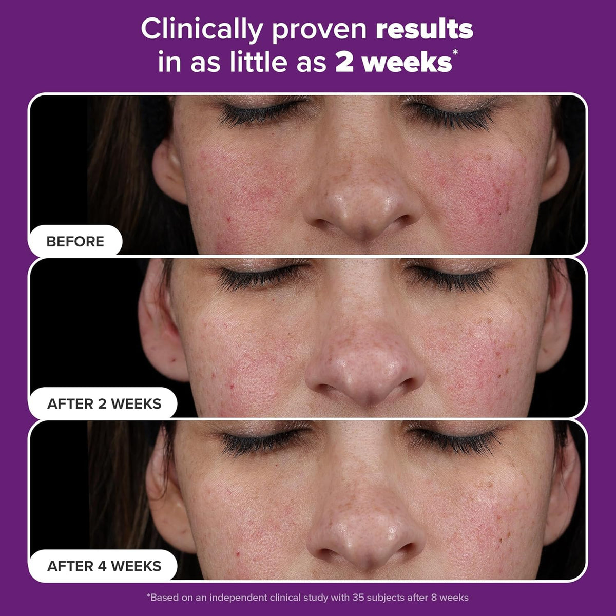 Paula's Choice - PRO Retinaldehyde Dual-Retinoid Treat 30ml