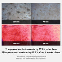 Medicube - Red Succinic Acid Peeling Pad (70ea)